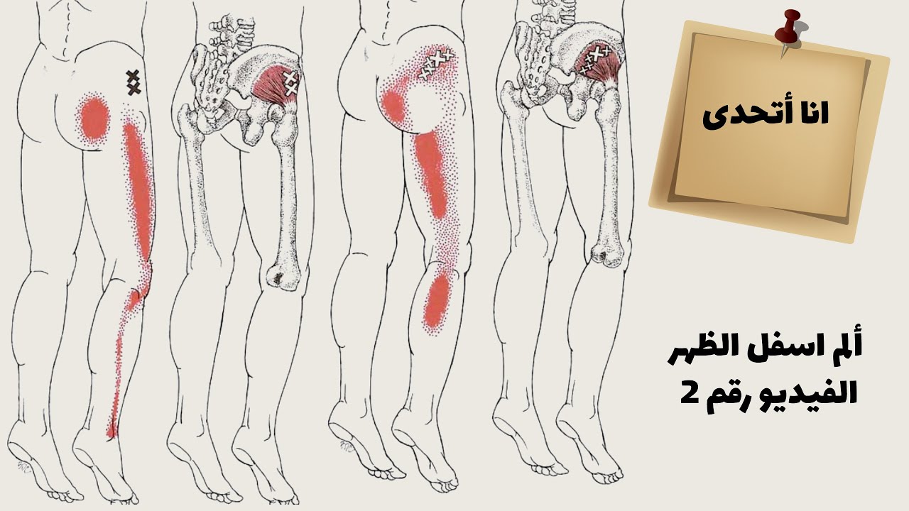انا اتحدى 2 - اتحدى ألم اسفل الظهر في حال المواظبة على التمارين الموجودة في الفيديو يوميا