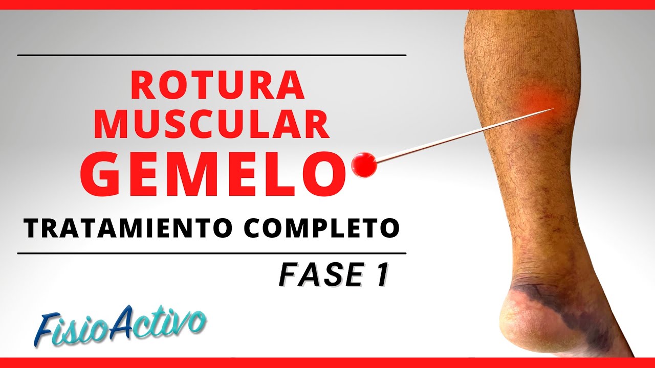 ROTURA MUSCULAR DE GEMELO 🦵🏼💥 Valoración y Tratamiento Completo + Ejercicios [CASO REAL] FASE 1