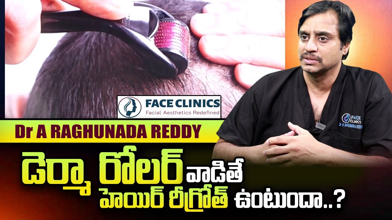 Derma Roller Uses and Benifits | Face Clinics | Dr.Raghunatha Reddy | SumanTV Telugu