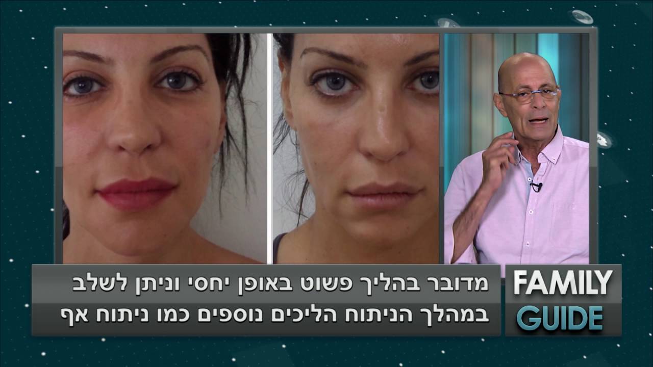 ד
