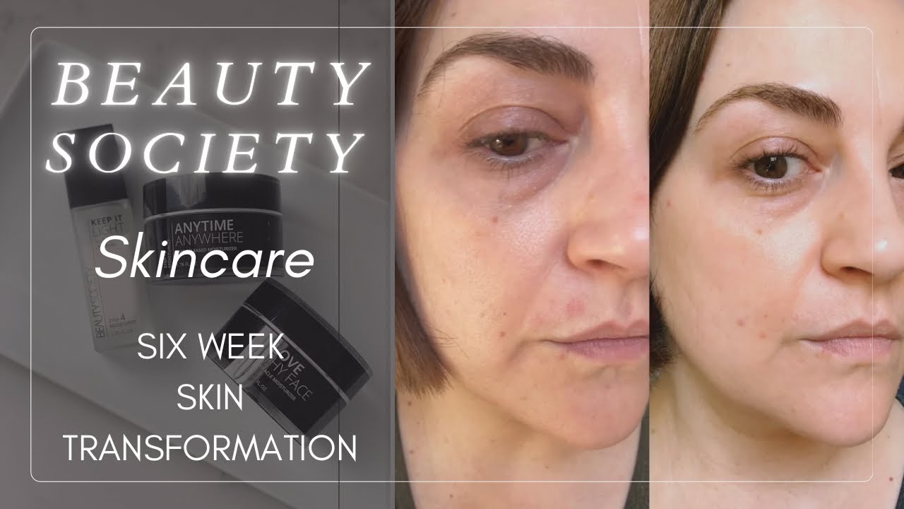 I Transformed My Skin in 45 days with Beauty Society