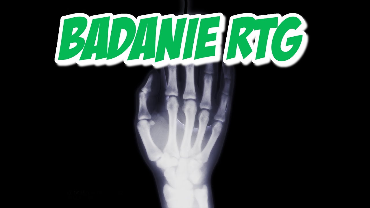Bo przecież liczy się wnętrze! Czyli czym jest badanie RTG?
