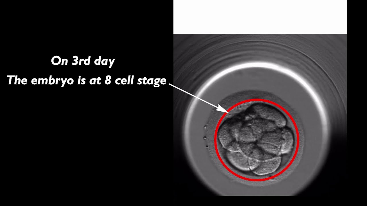 Embryo development in IVF lab from the time of fertilised to a blastocyst stage