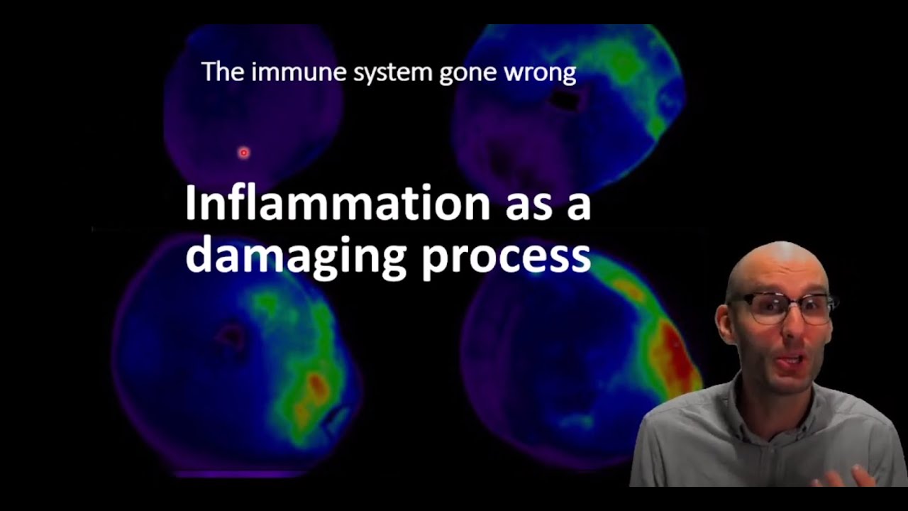How does inflammation causes tissue damage?
