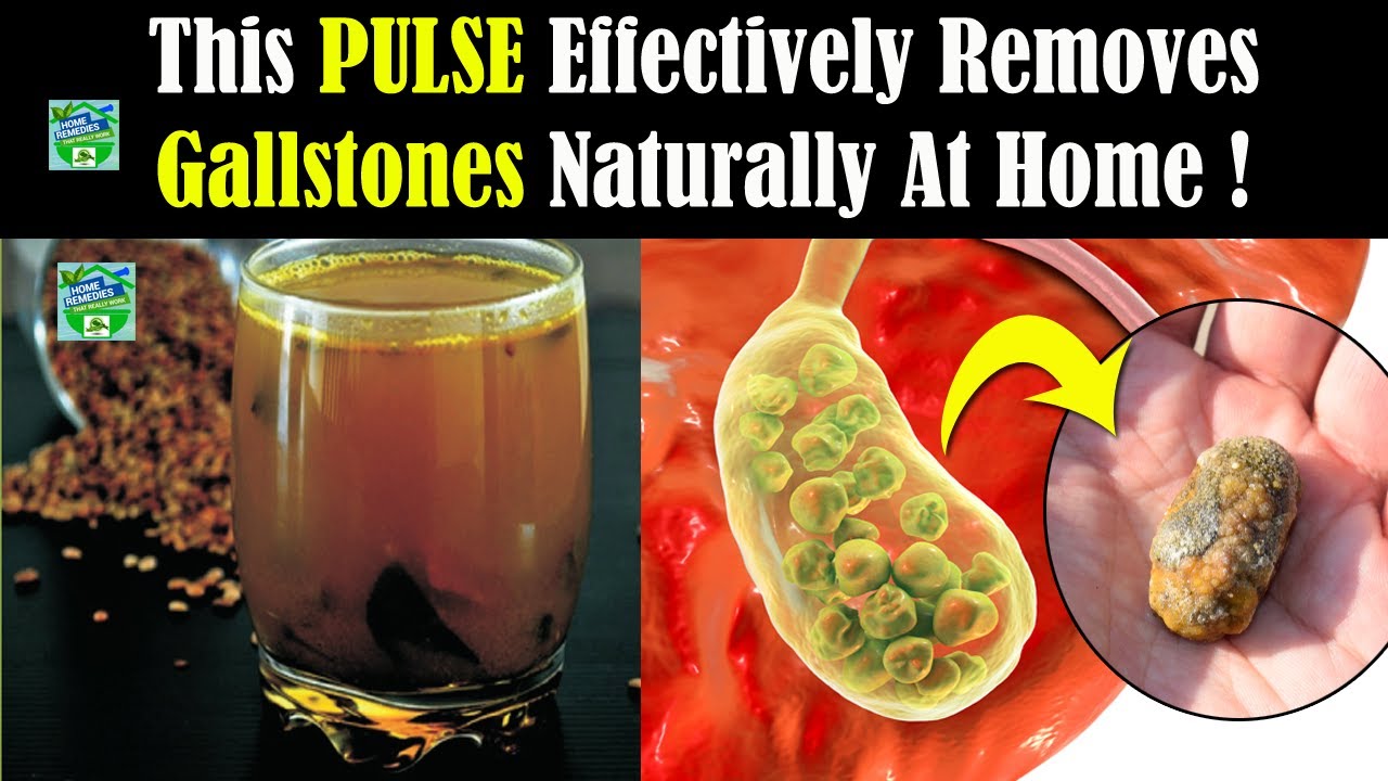 This PULSE Effectively Removes Gallstones Naturally At Home !