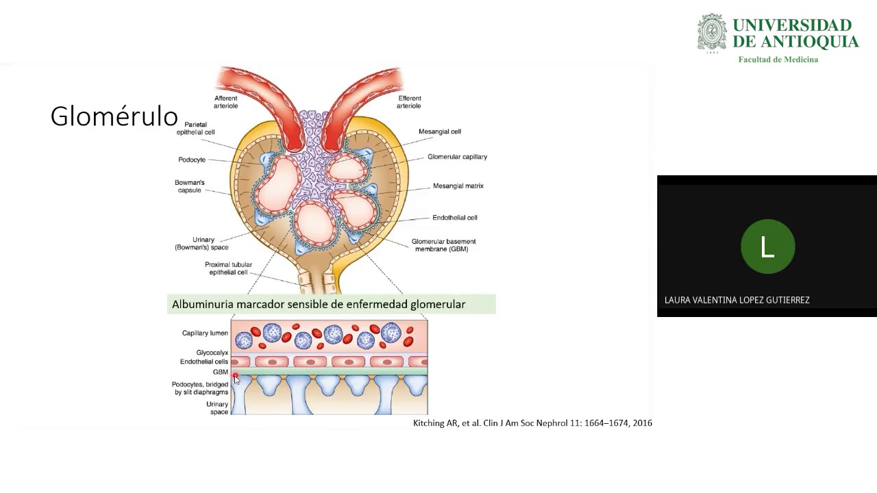 Enfoque del Paciente con Proteinuria - Dra. Laura Valentina López