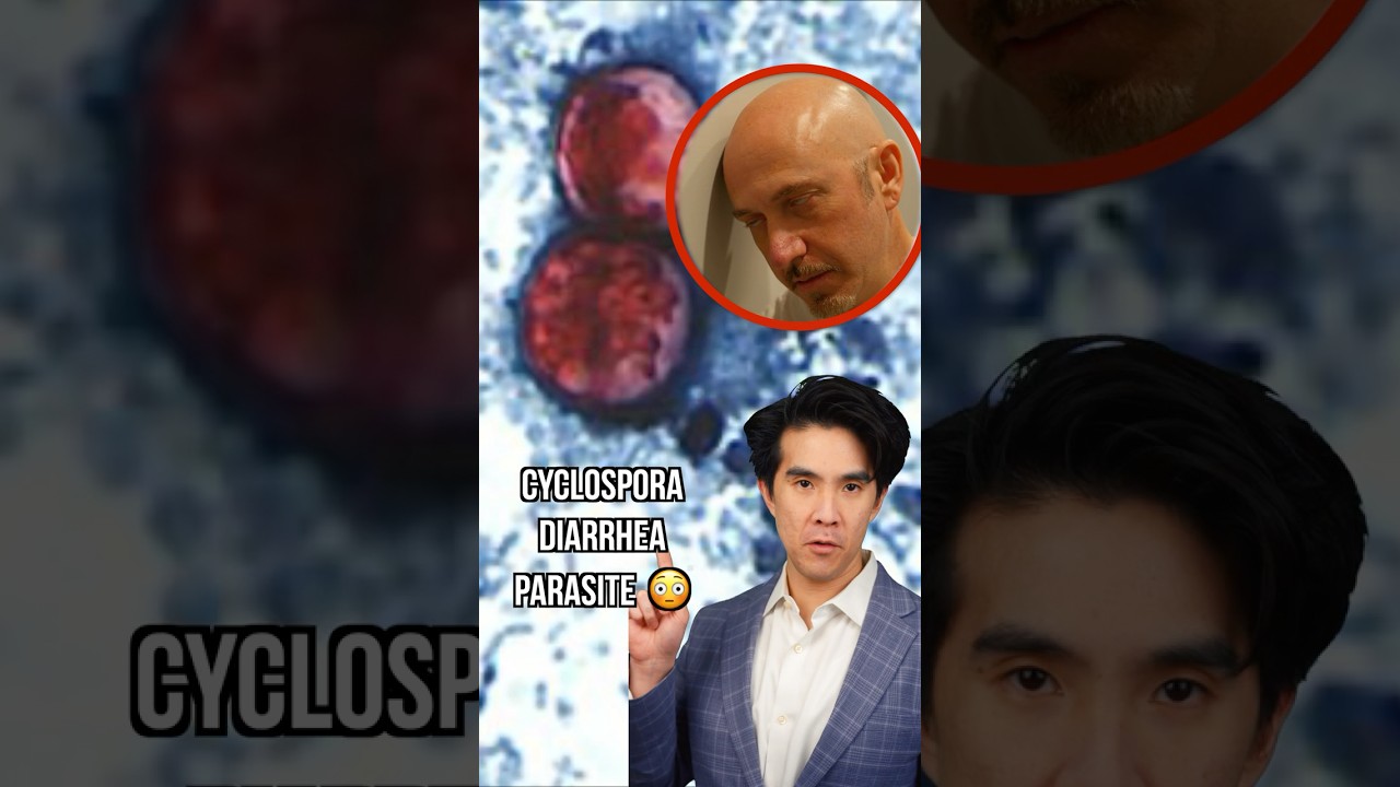 Diarrhea Parasite Situation Is Insane 😳