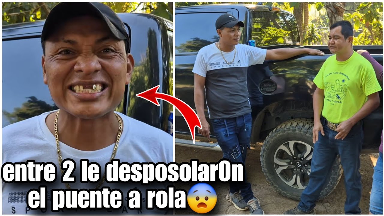 Por andar con malas compañias rola terminó perdiendo los dientes otra vez😳