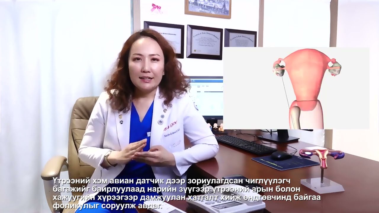 ЦУВРАЛ 16: ӨНДГӨН ЭС АВАХ АЖИЛБАР
