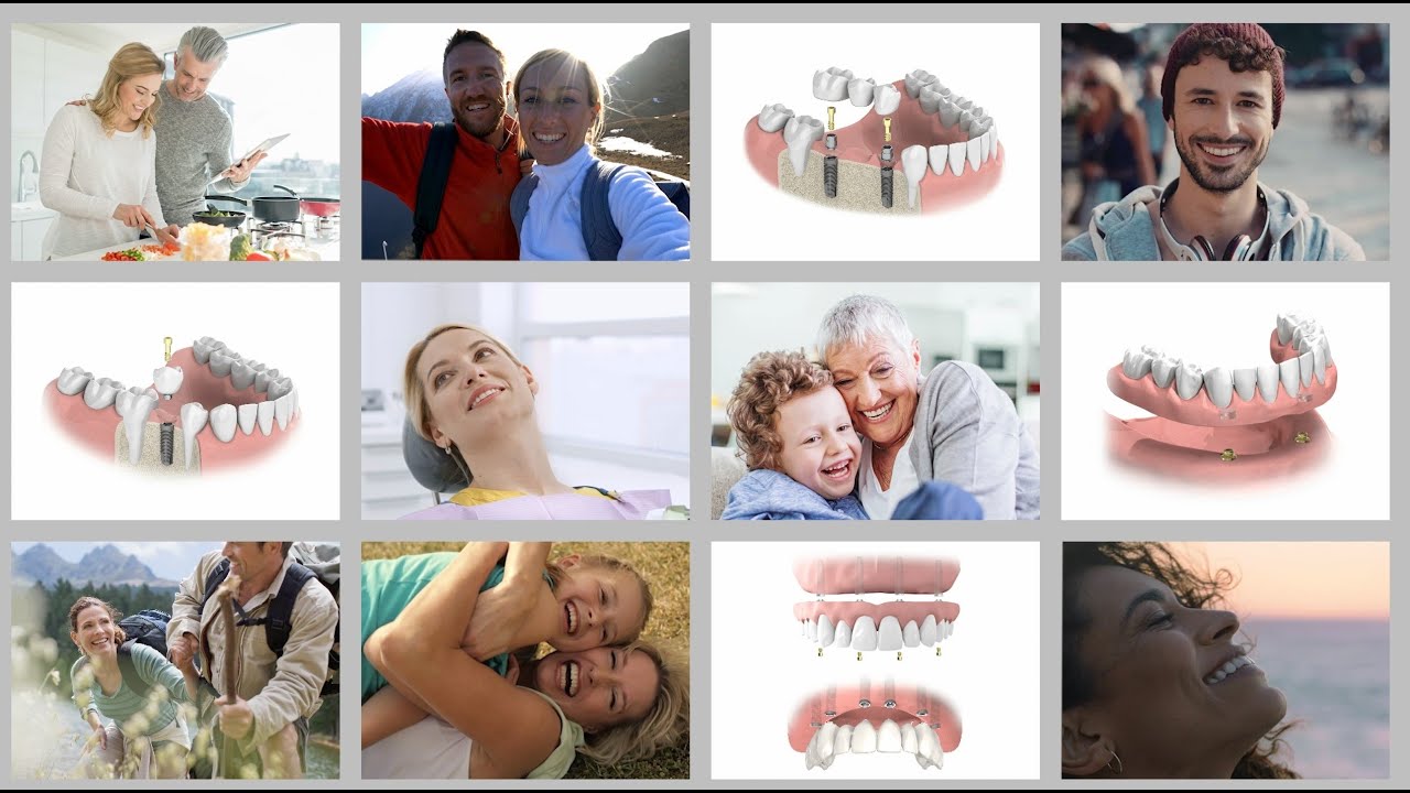 Neoss&reg; Patient Video