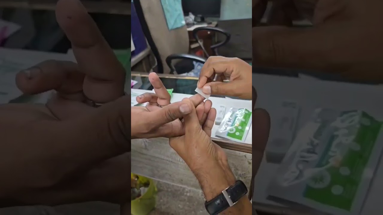 DENGUE NS1 TEST | HOW TO DENGUE CHECK IN HOME ☀️