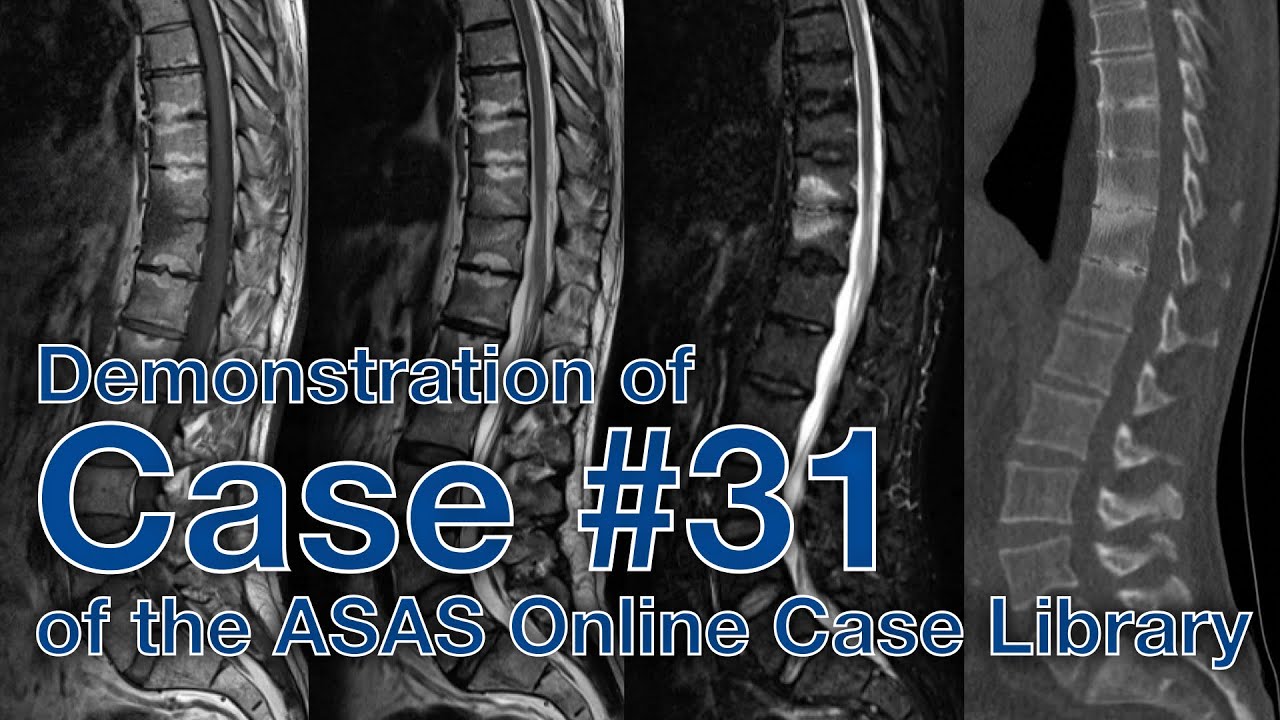 Demonstrating case #31 of the ASAS Online Case Library // by Dr. Kay G. Hermann