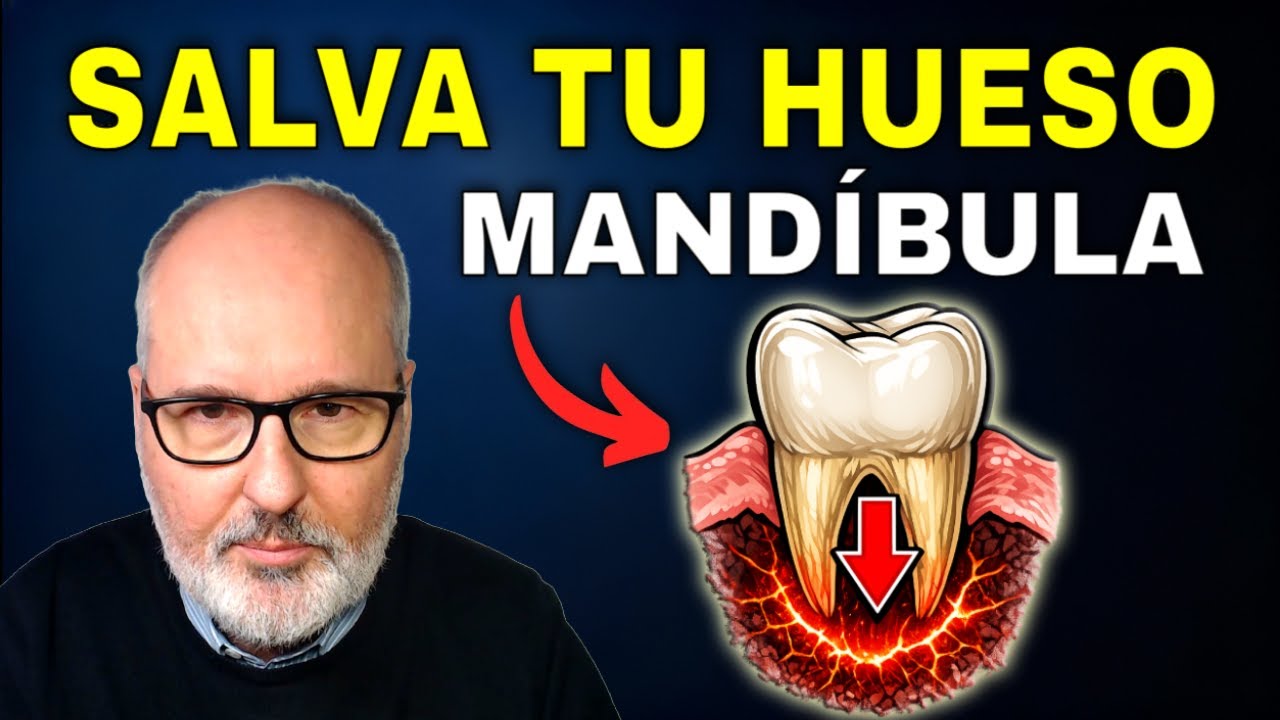 ¿Te falta hueso para implantes? Cómo salvar tu mandíbula