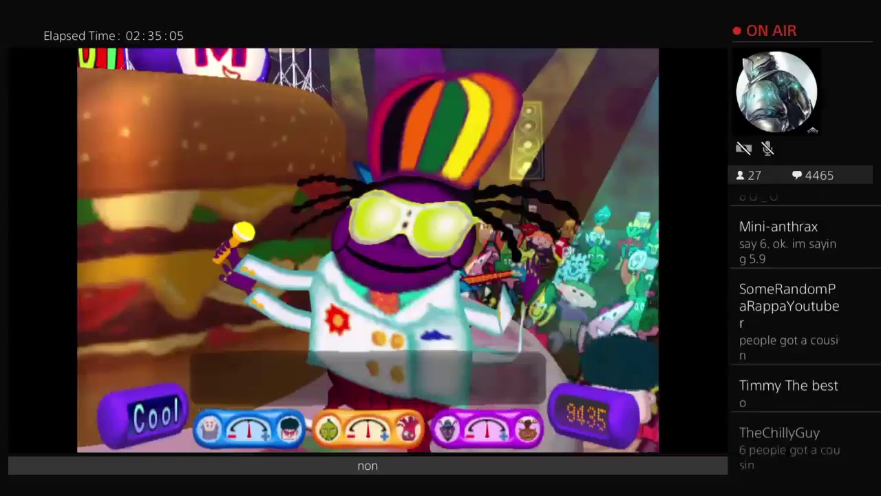 seizure stream