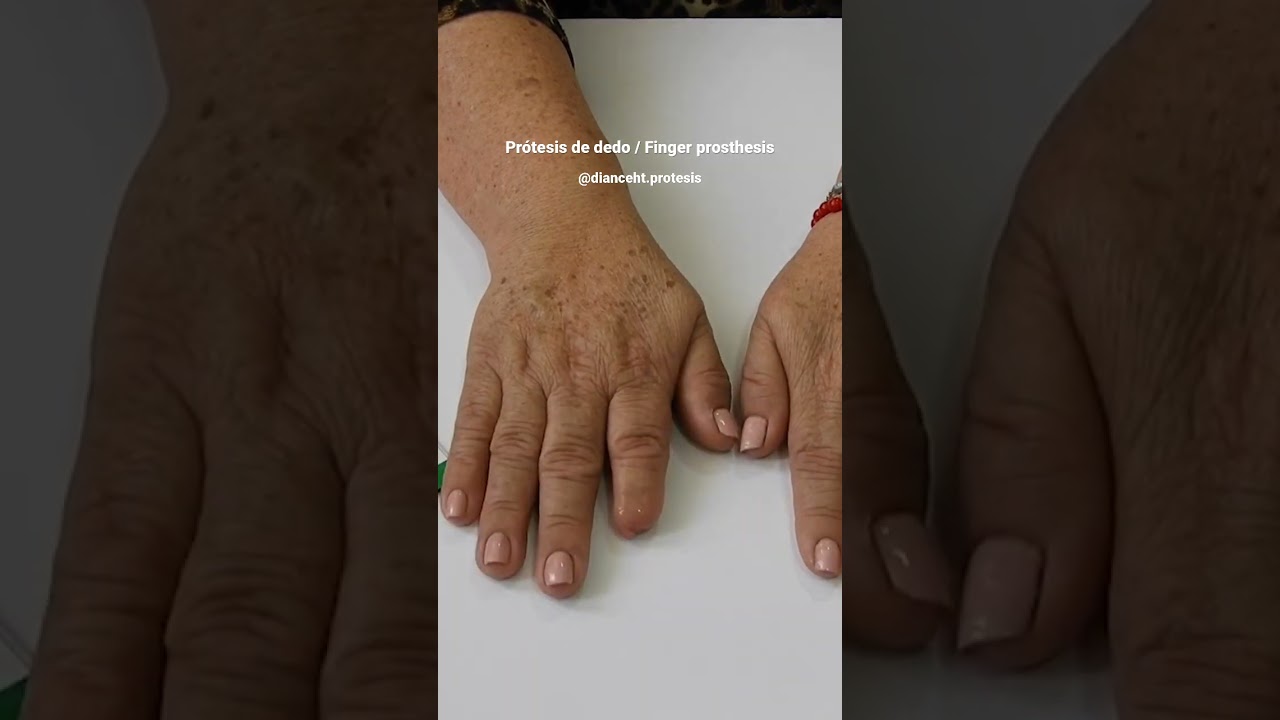 Pr&oacute;tesis est&eacute;tica de dedo 👆🏻/ Aesthetic finger prosthesis #protesis #prosthetics #viral #finger