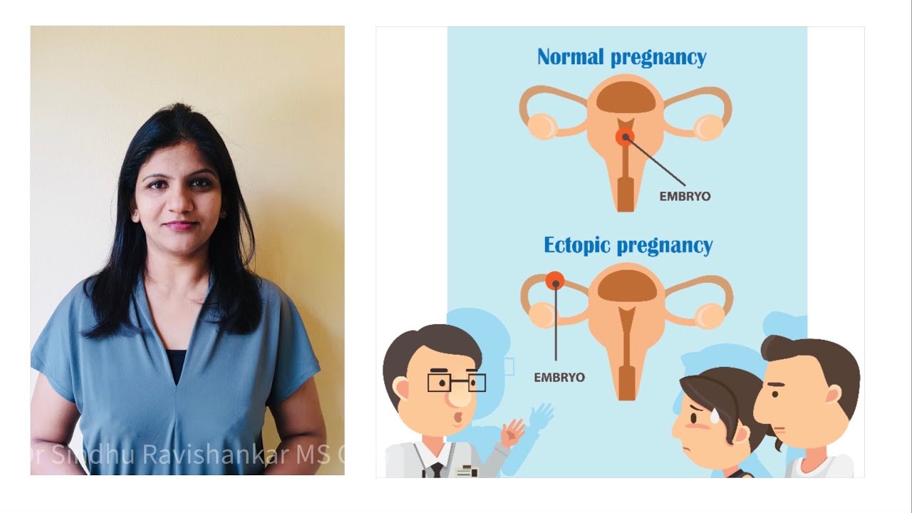 Ectopic Pregnancy signs and symptoms in Kannada