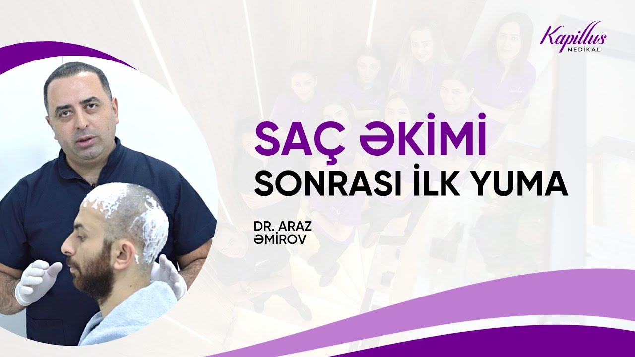 Kapillus Medikal | Saç əkimi sonrası ilk yuma