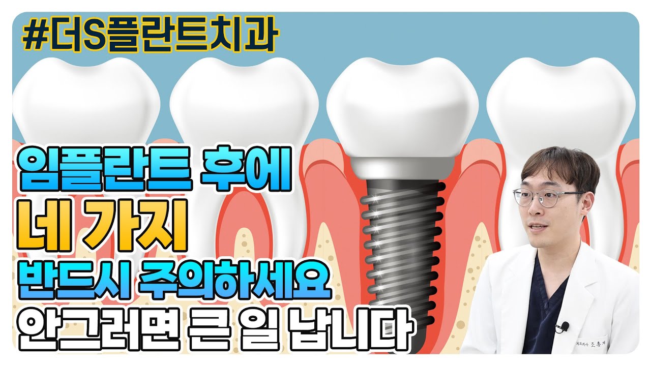 임플란트 후 4가지는 반드시 주의하세요 안그러면 큰일납니다