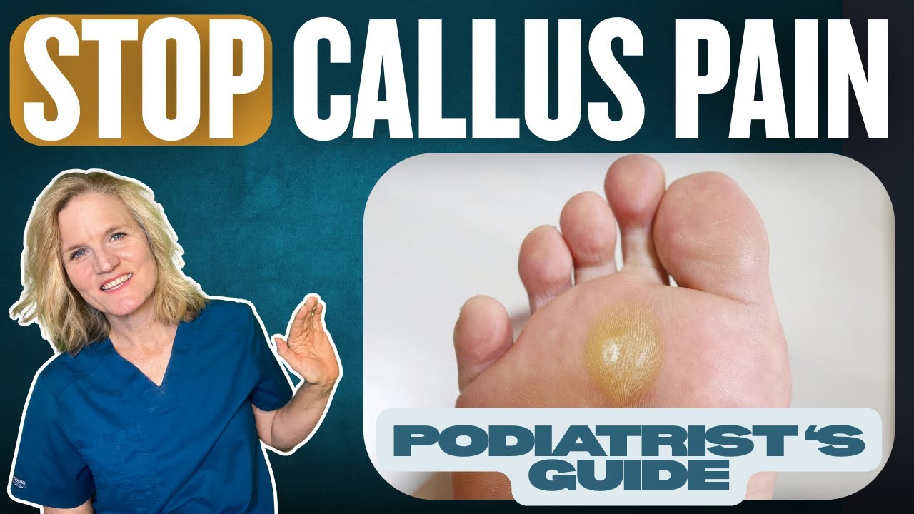 How to Stop Callus Pain by Customizing OTC Orthotics  and other DIY Help