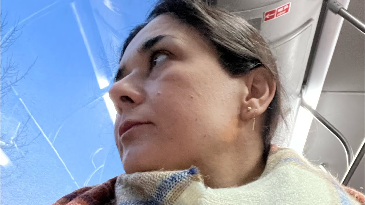((338))ƏMƏLYYAT BELƏ DÜŞÜNÜRƏM/YENİ ÜZ BAXIMI🥰👍🏻💃🏻/