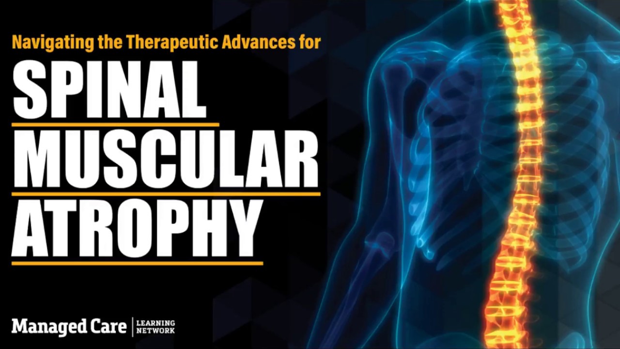 Spinal Muscular Atrophy: Navigating Recent Therapeutic Advances