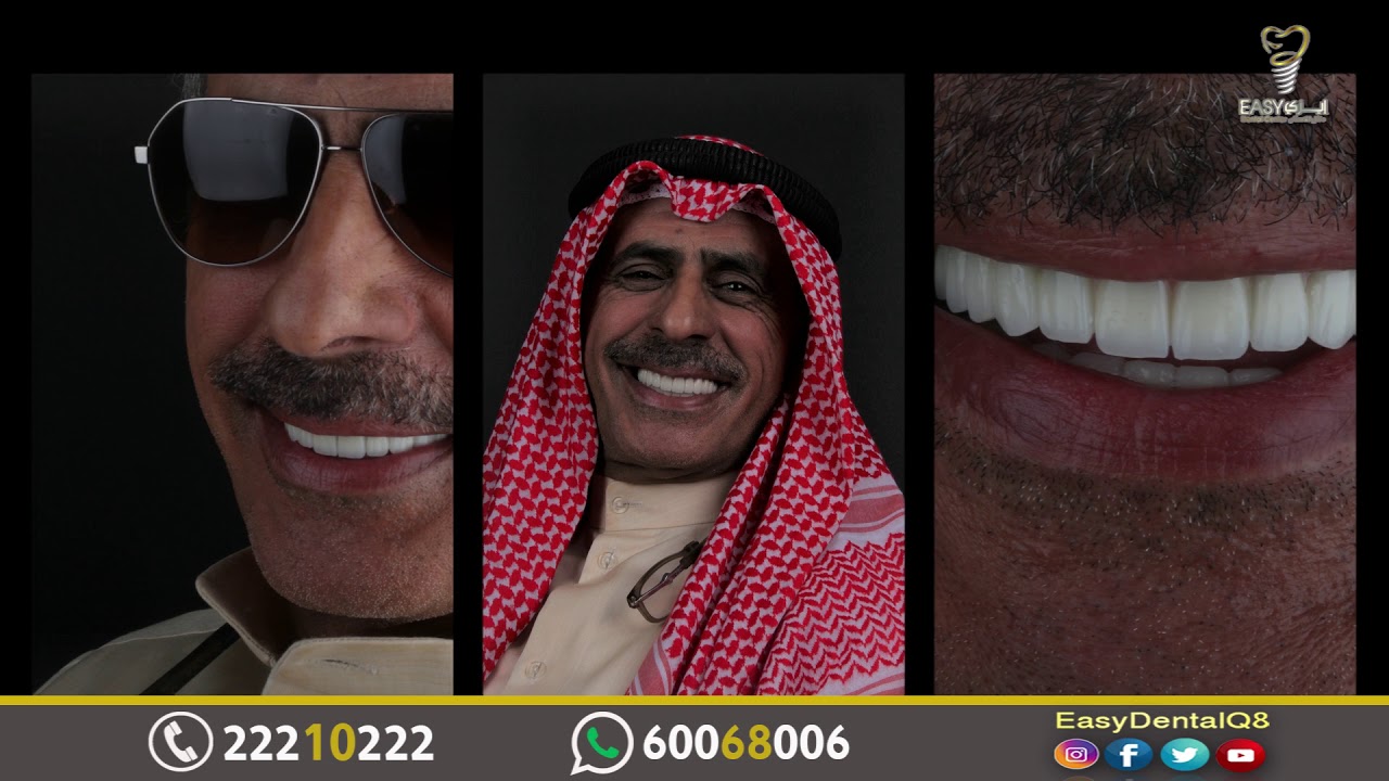 حالة زراعة أسنان فورية بطريقة سهلة واقتصادية  لدكتورة أنوار العطار بالكويت