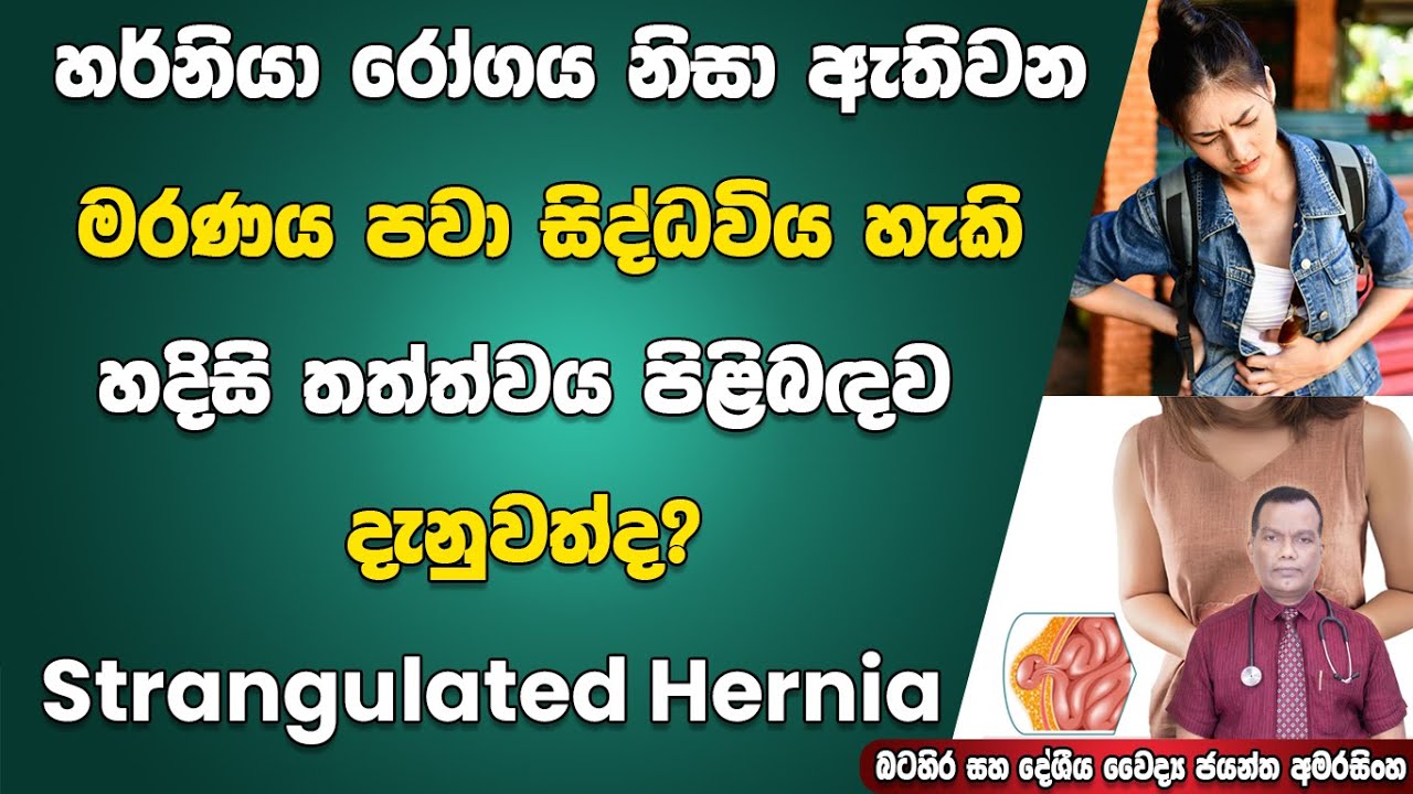 හර්නියා රෝගය නිසා ඇතිවන මරණය පවා සිද්ධවියහැකි හදිසි තත්ත්වය පිළිබඳව දැනුවත්වෙන්න Strangulated Hernia