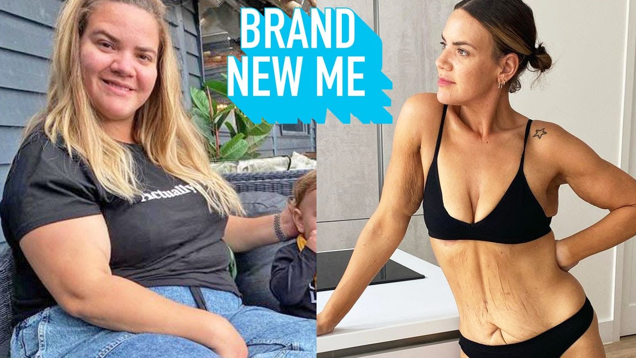 I Lost 120lbs - Now I'm Having My Loose Skin Removed | BRAND NEW ME