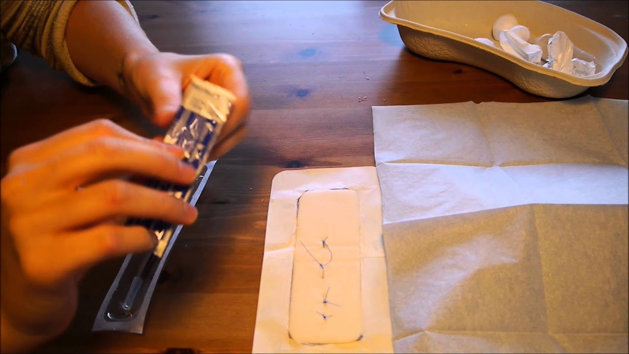 Ablation de fils de suture