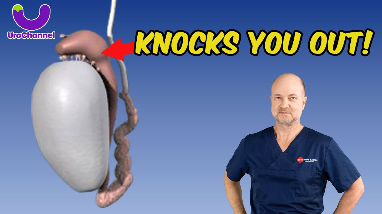 Pain In The Testicles Could Be EPIDIDYMITIS | UroChannel