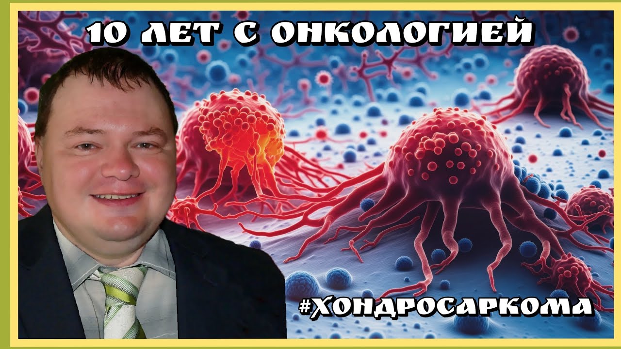 🆘10 лет с онкологией⛑️ позади три операции. Диагноз хондросаркома #Мачнев_Сергей_Юрьевич2️⃣0️⃣2️⃣5️⃣