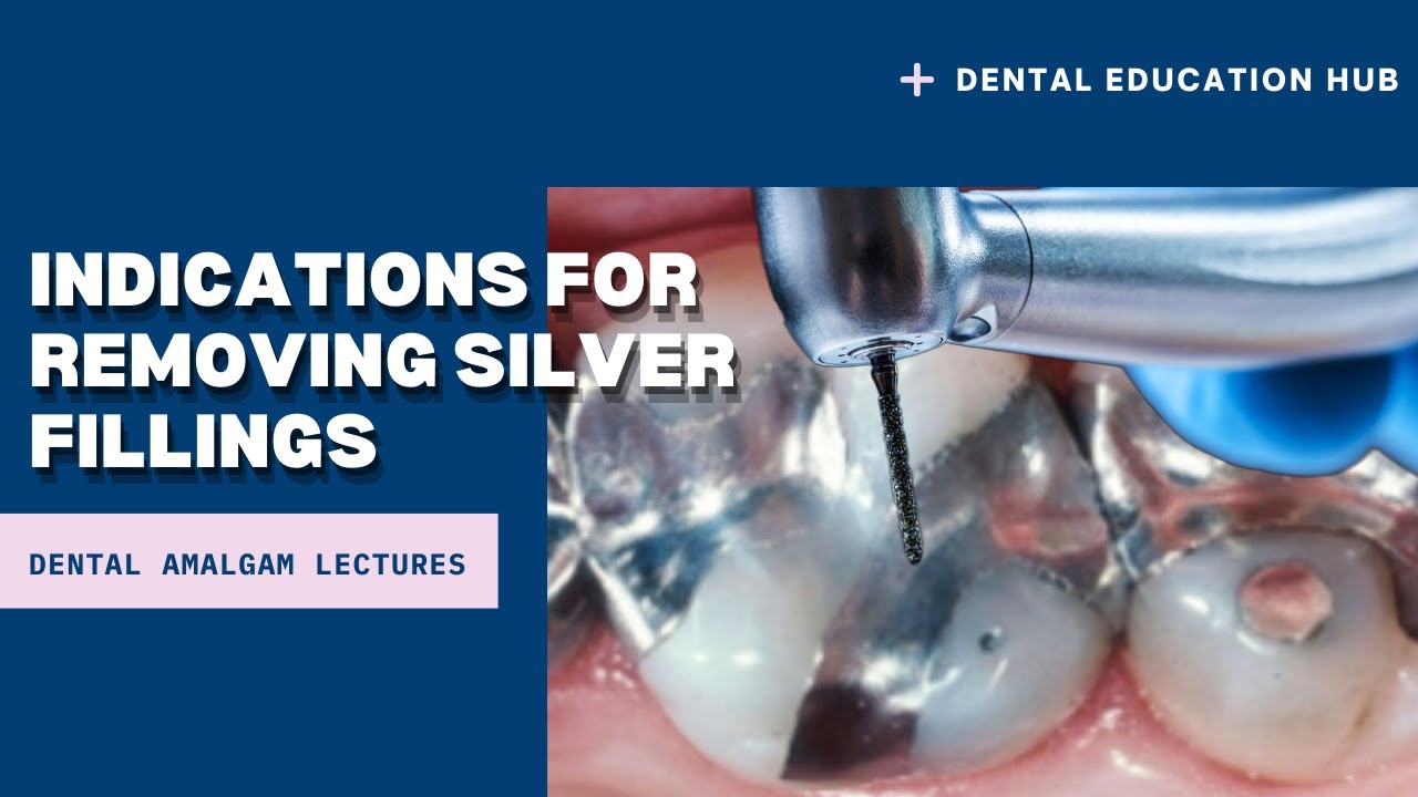 Indications for Removing Silver Fillings | Dental Amalgam Fillings