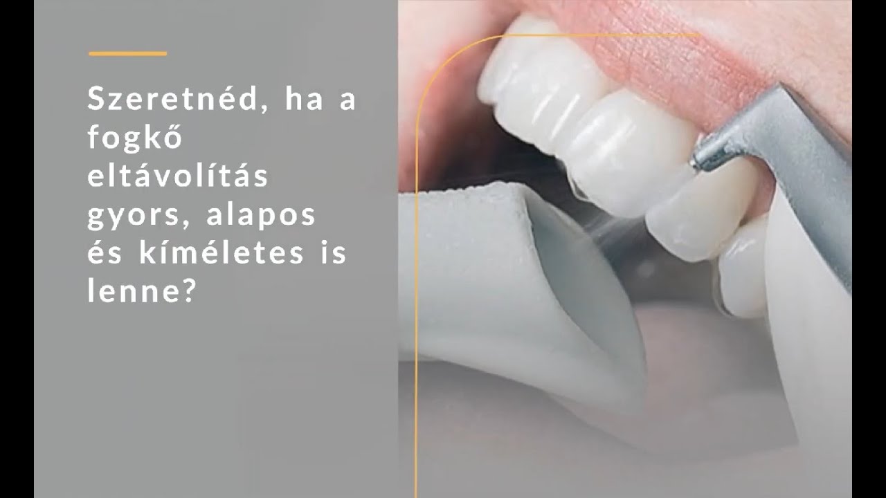 Modern fogkőeltávolítás - Irányított Biofilm terápia a Clinidentben