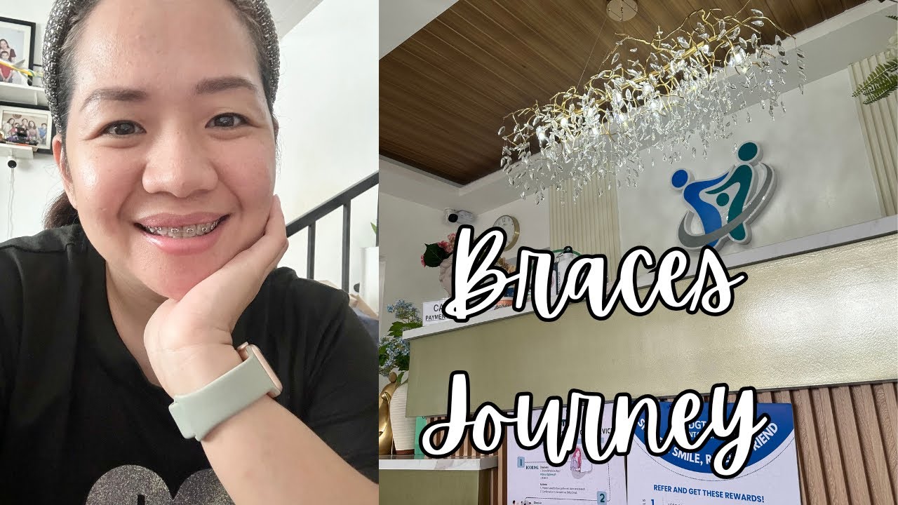 MY BRACES JOURNEY WITH DGT ONE DENTAL CLINIC