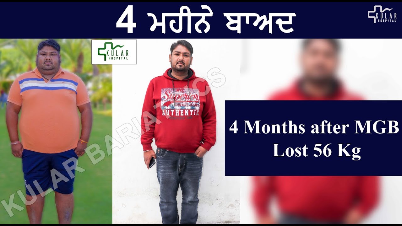 Best Surgery for Weight Loss & Sleep Apnoea | India | Punjab | Dr. Kular
