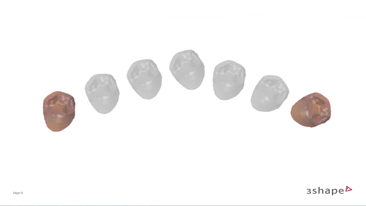 3Shape Clear Aligner Studio - Setup and Staging Assistance - Way-points BR PT