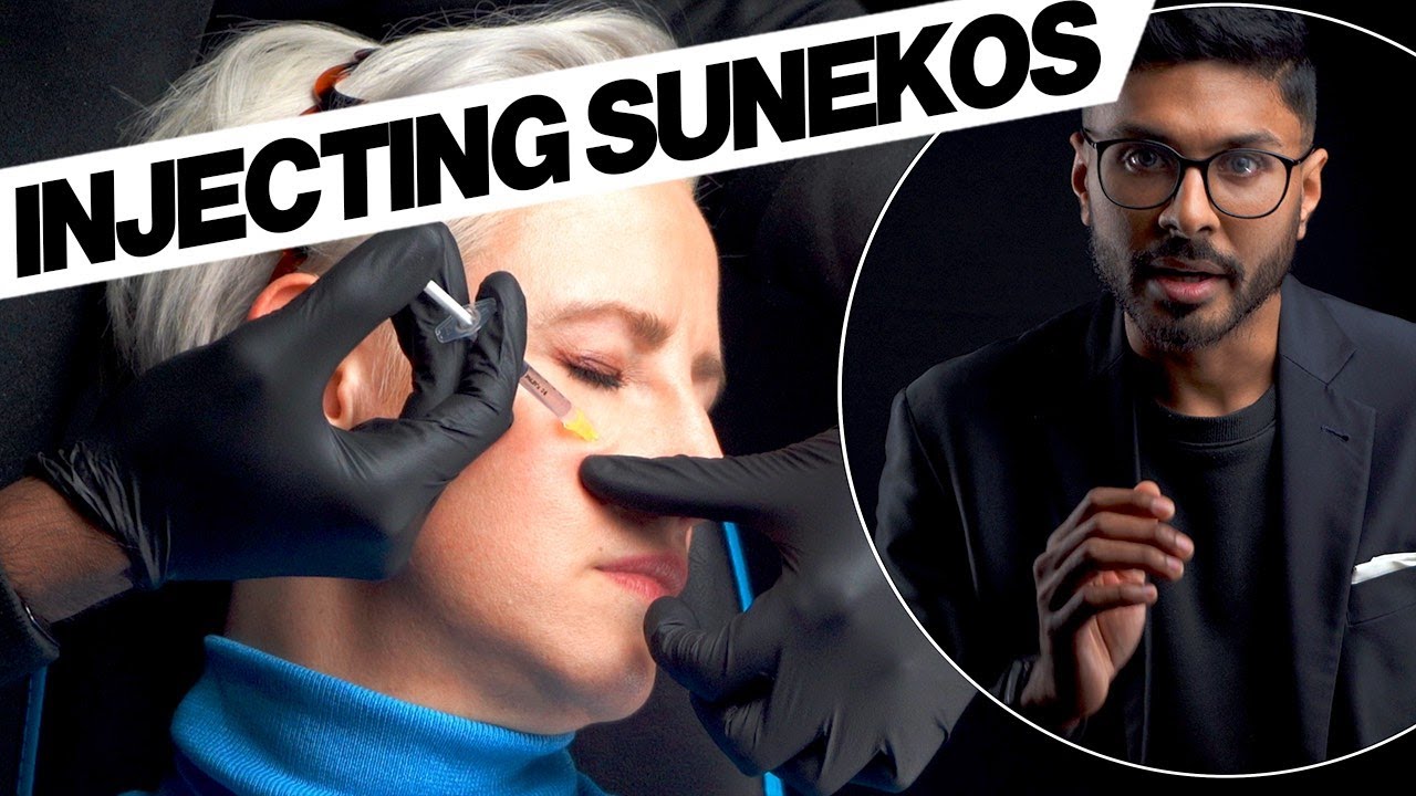 Sunekos Performa Injection Technique Face