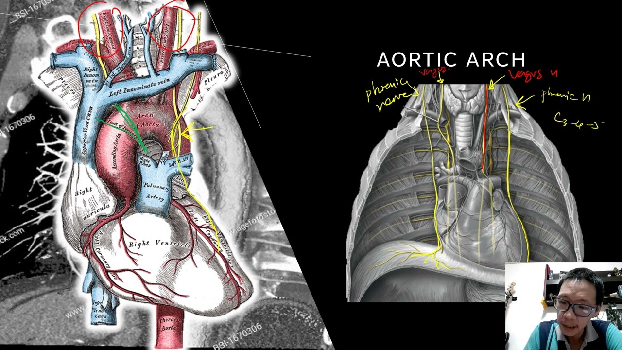 คลิปประกอบการเรียนการสอน aortic disease นักศึกษาแพทย์ชั้นปีที่ 5 ตั้งแต่ปีการศึกษา 2567 เป็นต้นไป