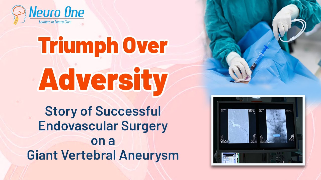 Triumph Over Adversity: Successful Endovascular Surgery on a Giant Vertebral Aneurysm at 75