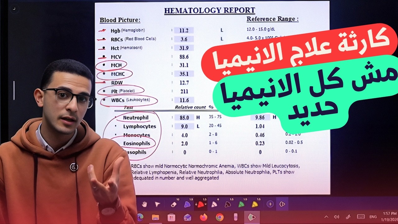 متاخدش علاج للأنيميا قبل ما تعرف نوعها من التحليل ده! (شرح مفصل لصورة الدم الكاملة CBC)