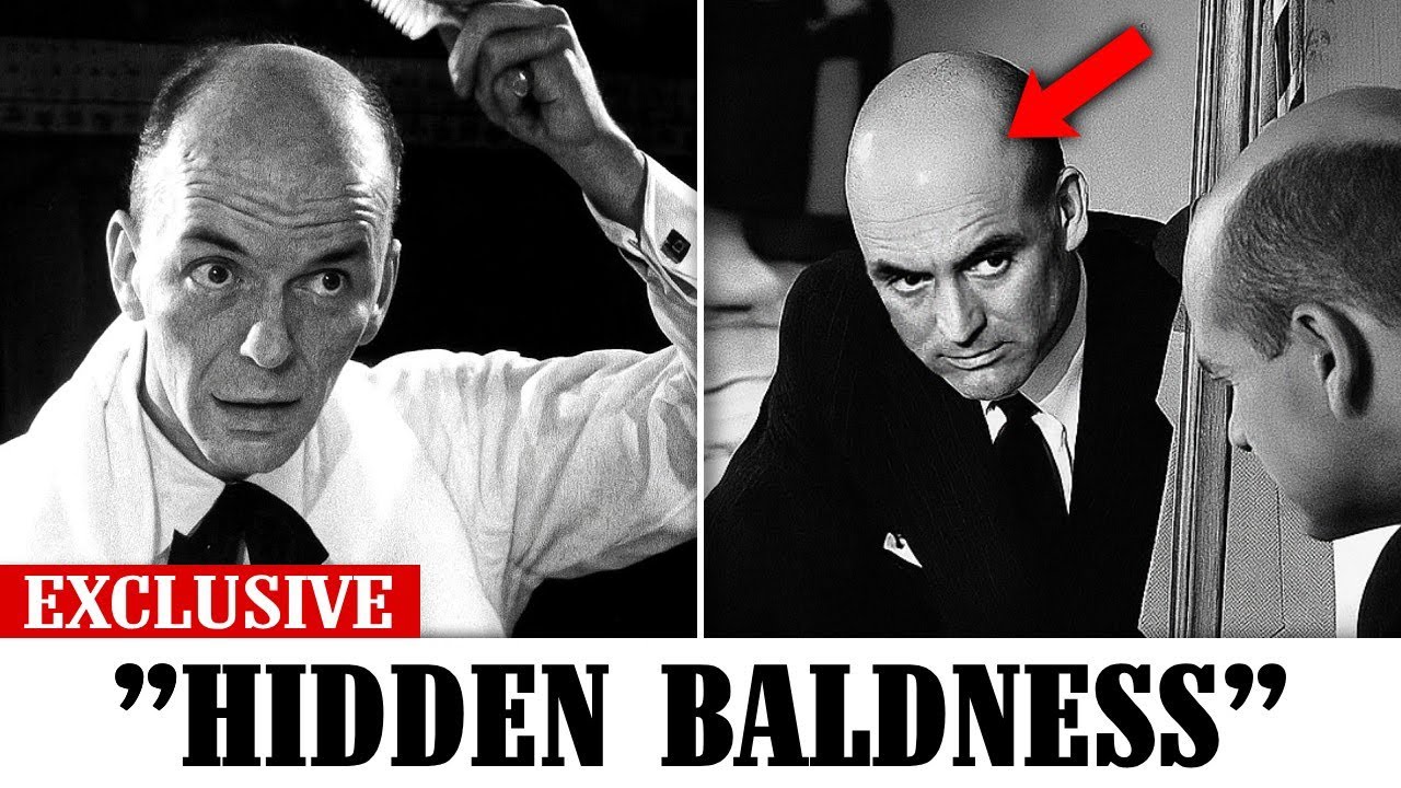 15 Golden Age Stars Who Hid Their Baldness for Years With Wigs