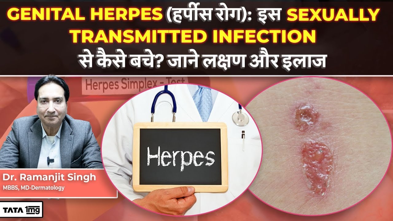 Genital Herpes: गुप्तांग में herpes Infection क्या है? कैसे बचे? और जाने इलाज | STD | Dr Ramanjit