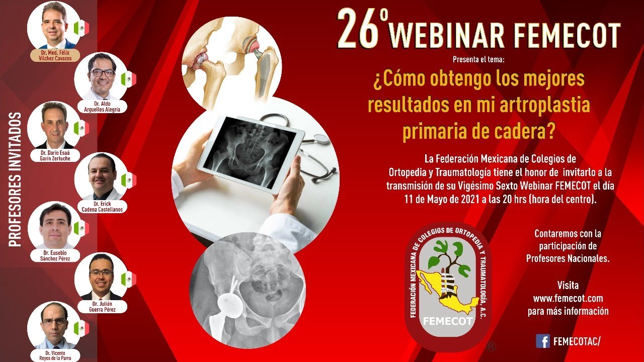 ¿Cómo obtengo los mejores resultados en mi artroplastia primaria de cadera?