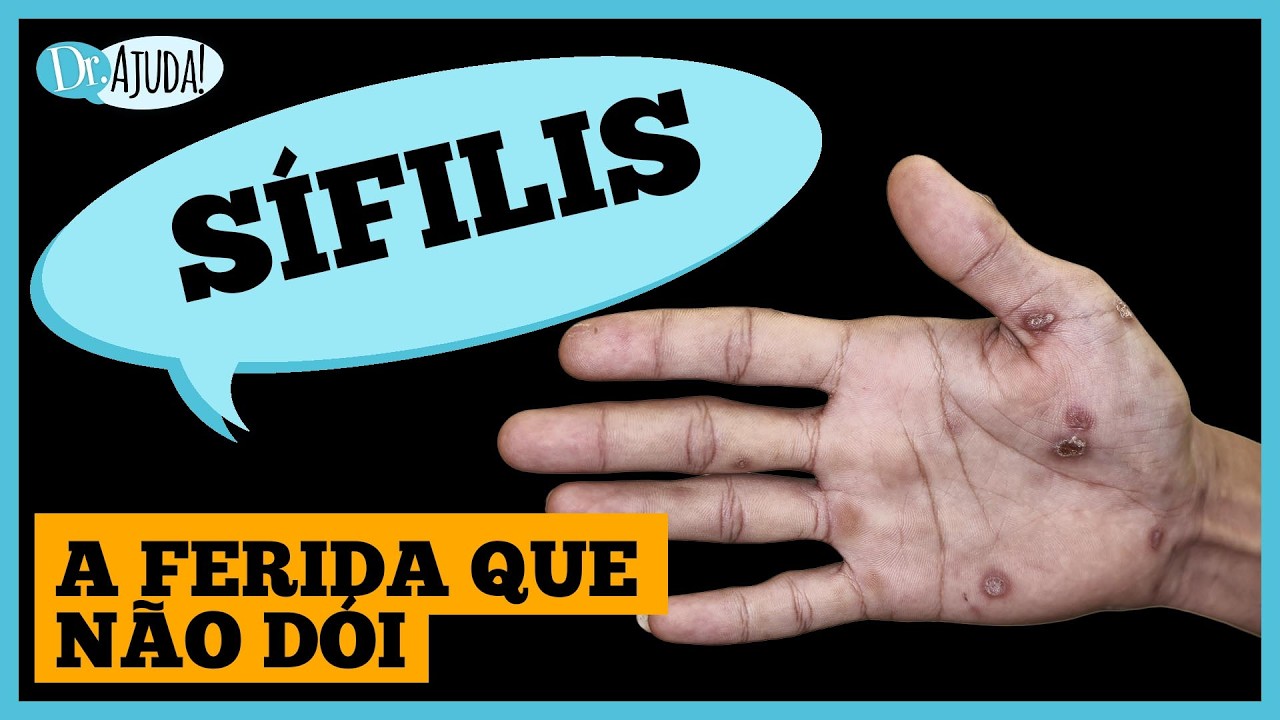Feridas que somem de repente? Pode ser S&Iacute;FILIS