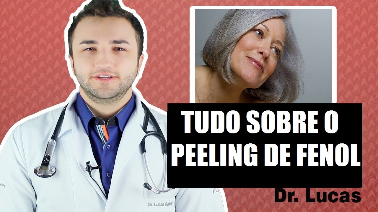 Tudo sobre o Peeling de Fenol - Dr Lucas Fustinoni
