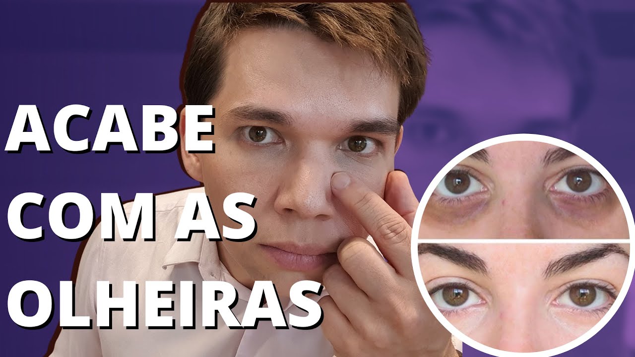 ACABE com as OLHEIRAS: REVELADO - Guia Completo