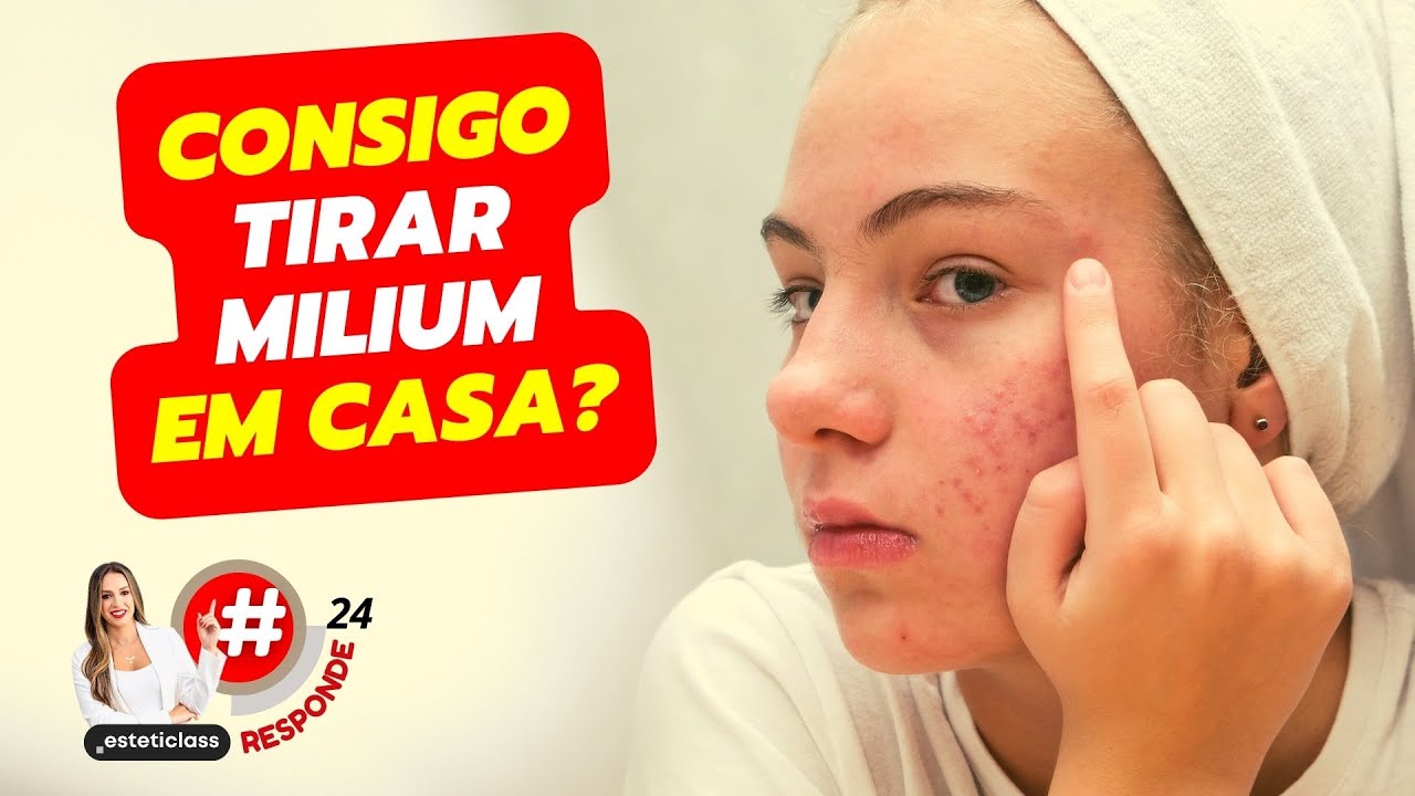 🛑 CONSIGO TIRAR MILIUM EM CASA?   #aula