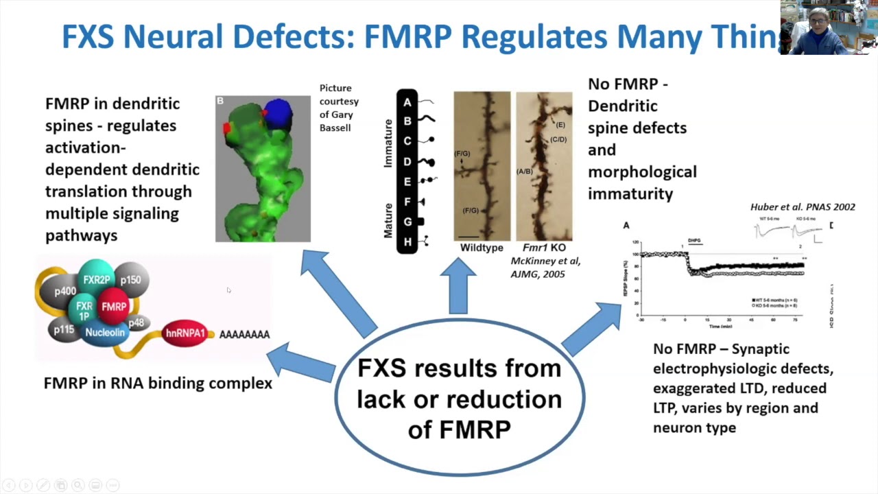 Elizabeth Berry-Kravis - Clinical Trials and Cyclic AMP in Fragile X Syndrome (February 24, 2021)