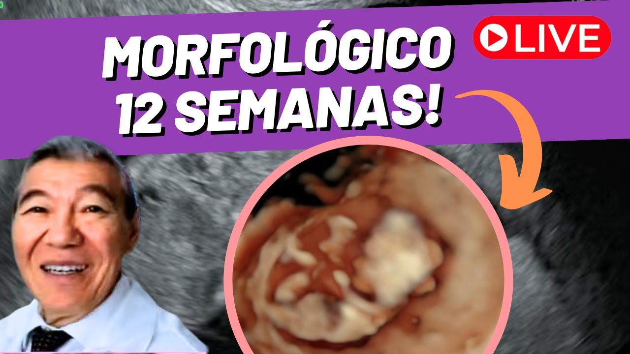 AO VIVO - MORFOLÓGICO 12 SEMANAS