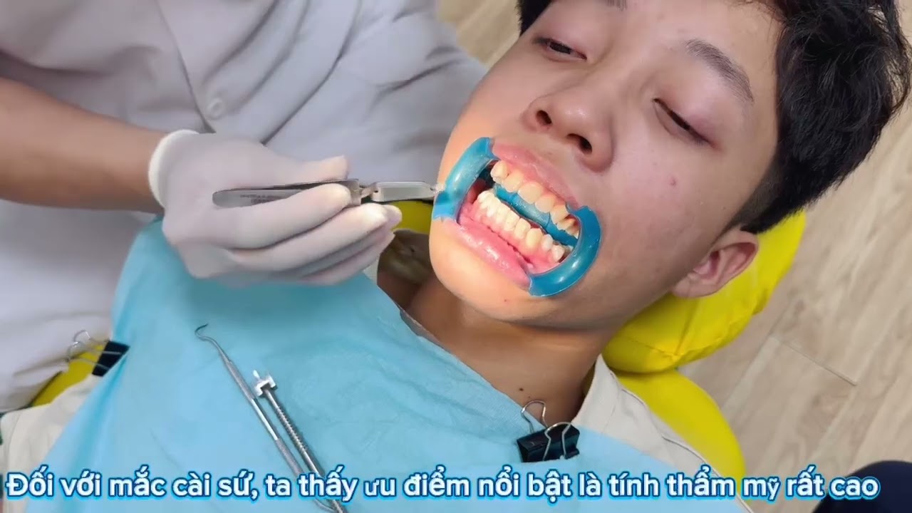 GẢ THÀNH CÔNG EM 